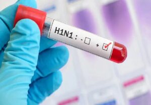 Swine Flu