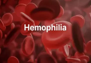 Hemophilia