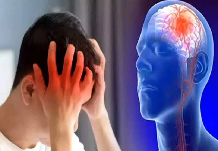ਬ੍ਰੇਨ ਸਟ੍ਰੋਕ