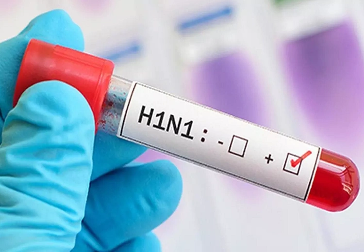 Swine flu cases in Delhi